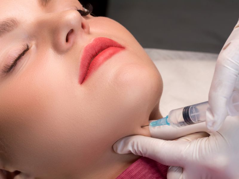 beneficios del lipofilling facial